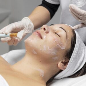 Exfoliación profunda