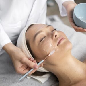 Peeling químico