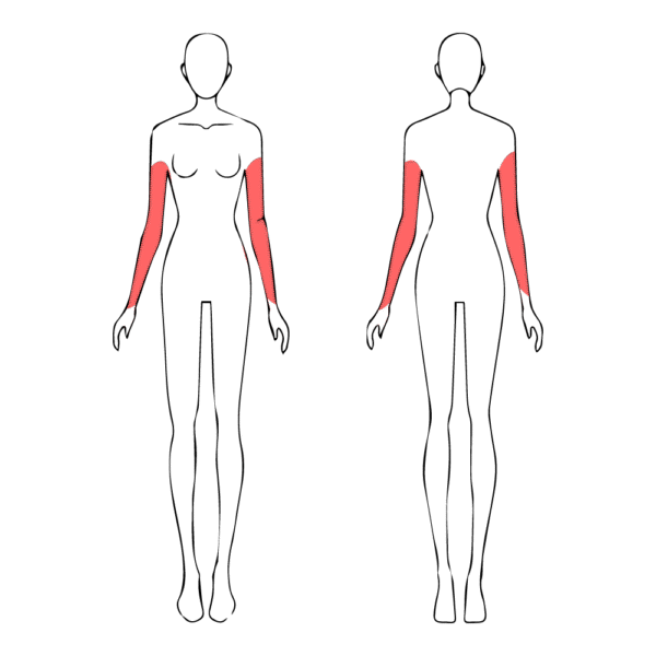 Brazos - Imagen 2