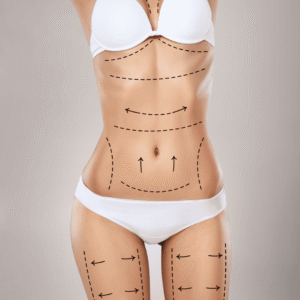 Lipo Crio Max
